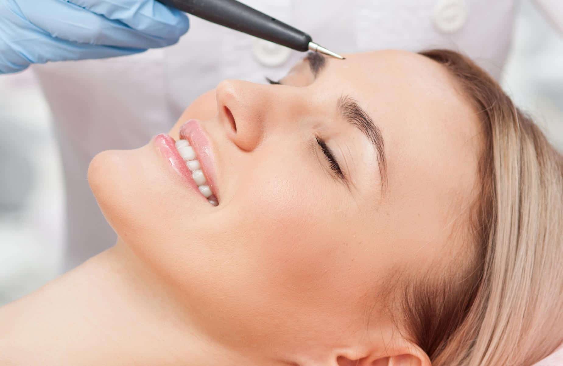 Lyons Electrolysis Birmingham Electrolysis Permanent Hair Removal